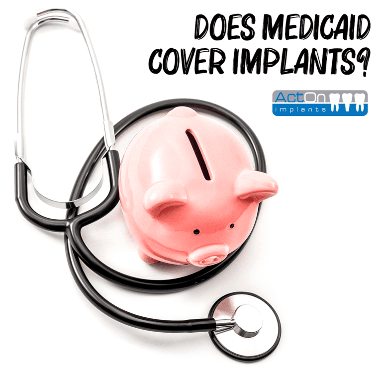 Does Medicaid Cover Dental Implants? ActOn Implants