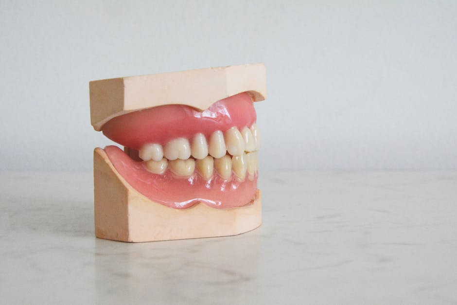 The Most Common Problems With Traditional Dentures